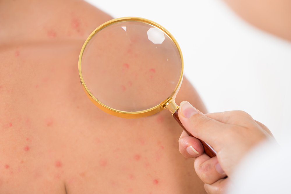 Common Skin Conditions Diagnosed by Dermatologists
