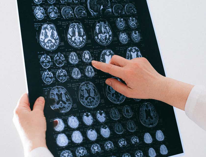 Breaking Down the Role of a Neurologist