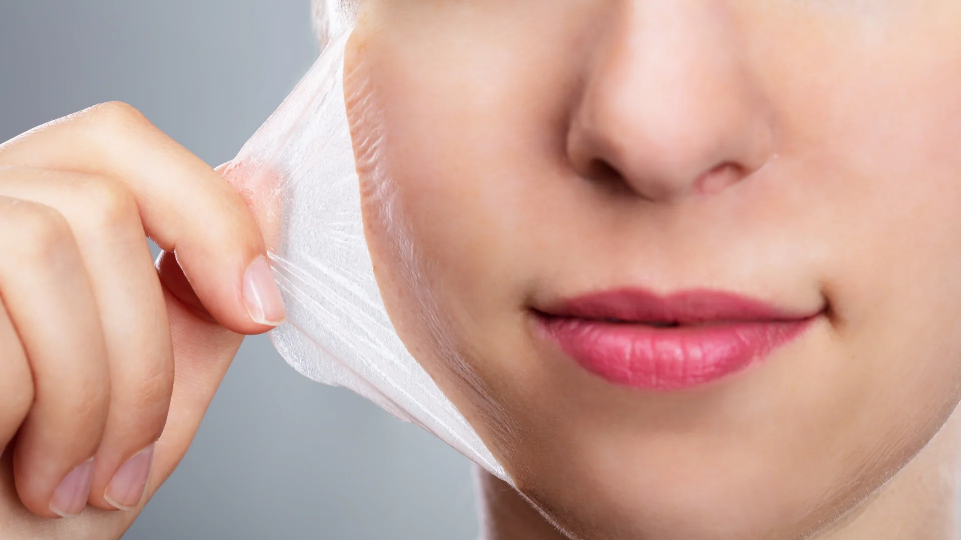 Why Should You Consider Doing Chemical Peels in Fort Worth?