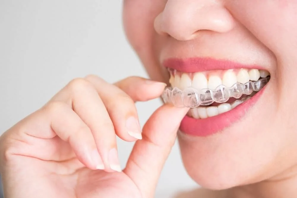Everything You Need to Know About Invisalign and its Effectiveness